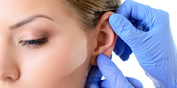 Отопластика