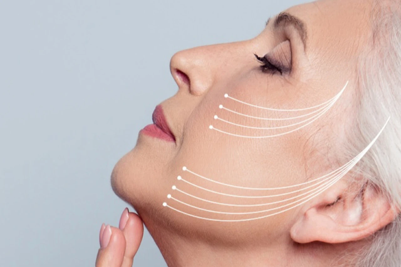 Каскадный лифтинг лица