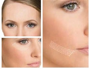 Мезонити - фото