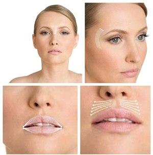 Нити Аптос - фото