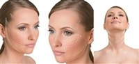 Подтяжка лица Аптос