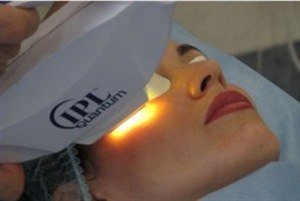 Фотоомоложение лица