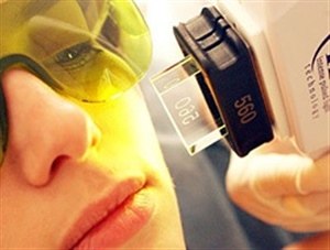 Лазерное удаление сосудистых звездочек (телеангиэктазий)