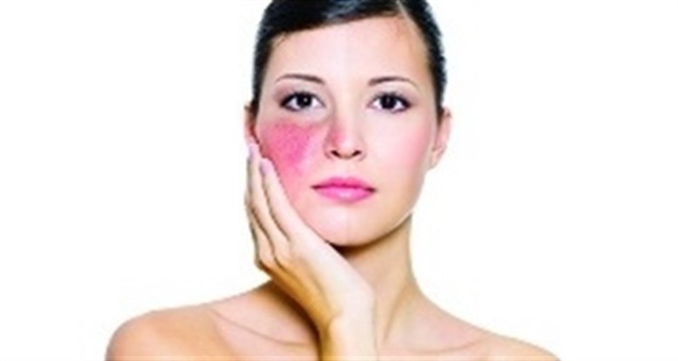 Лечение гемангиом